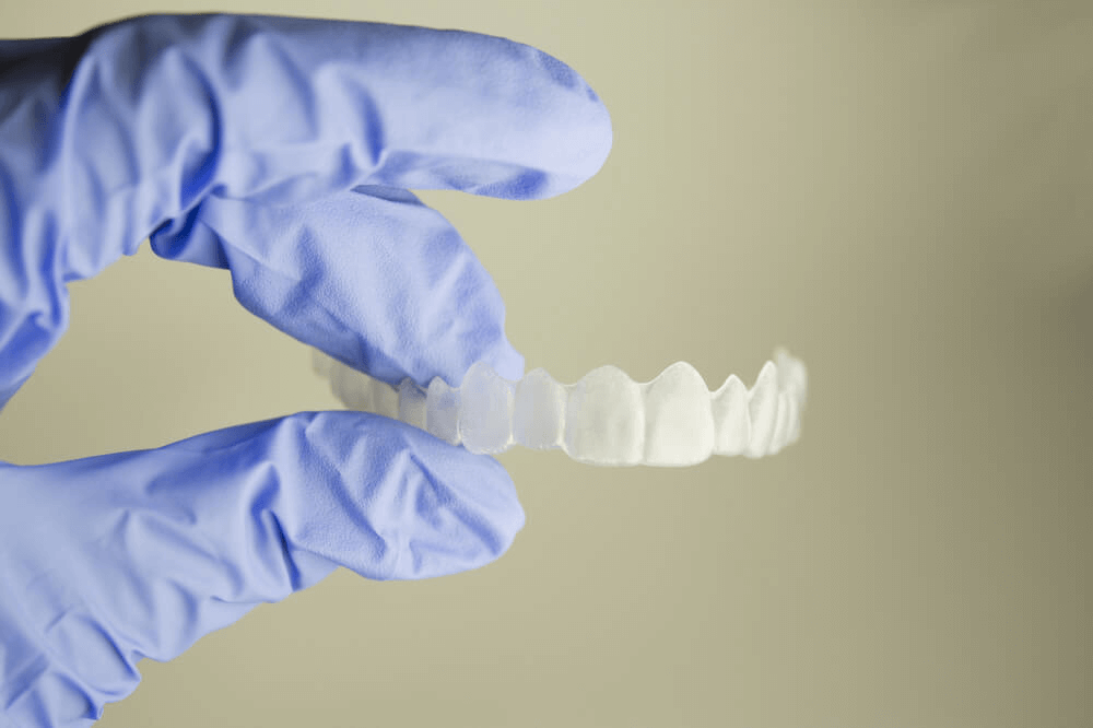 Aligneurs Invisalign et Biomecanique en Orthodontie